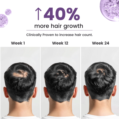 Neuherbs Hair Biotin Capsules - DHT Blocker Hair Supplement